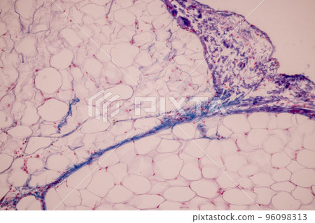 Tissue of Blood human, Vein human, Artery human and Heart muscle human under the microscope in Lab. Tissue of Blood human, Vein human, Artery human and Heart muscle human under the microscope in Lab. 96098313