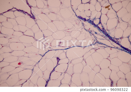 Tissue of Blood human, Vein human, Artery human and Heart muscle human under the microscope in Lab. Tissue of Blood human, Vein human, Artery human and Heart muscle human under the microscope in Lab. 96098322