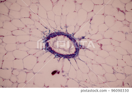Tissue of Blood human, Vein human, Artery human and Heart muscle human under the microscope in Lab. Tissue of Blood human, Vein human, Artery human and Heart muscle human under the microscope in Lab. 96098330