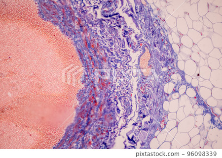 Tissue of Blood human, Vein human, Artery human and Heart muscle human under the microscope in Lab. Tissue of Blood human, Vein human, Artery human and Heart muscle human under the microscope in Lab. 96098339