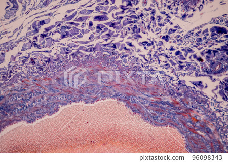 Tissue of Blood human, Vein human, Artery human and Heart muscle human under the microscope in Lab. Tissue of Blood human, Vein human, Artery human and Heart muscle human under the microscope in Lab. 96098343