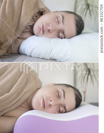 Before and after. On one frame, mimic folds from the wrong pillow. There are no wrinkles in the other photo, as an orthopedic pillow is used. Cosmetology and dermatology Before and after. On one frame, mimic folds from the wrong pillow. There are no wrinkles in the other photo, as an orthopedic pillow is used. Cosmetology and dermatology 96102704