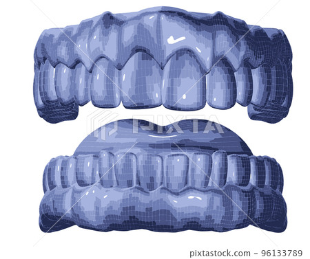 3d image of denture mesh 96133789