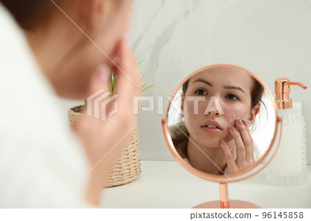Teen girl applying acne healing patch using mirror indoors Teen girl applying acne healing patch using mirror indoors 96145858