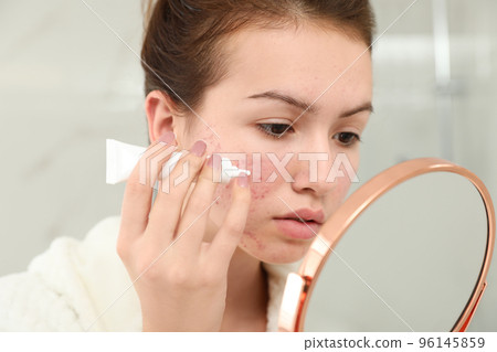 Teen girl with acne problem applying cream using mirror in bathroom Teen girl with acne problem applying cream using mirror in bathroom 96145859
