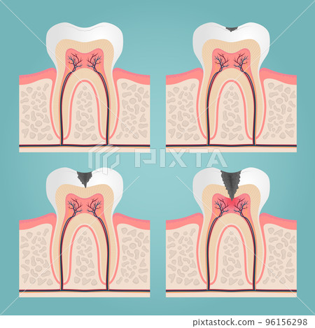 tooth anatomy 96156298