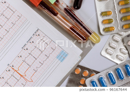 When doctor examines cardiogram, he will prescribe treatments for heart disease that will be followed by different pills that in order to provide better result When doctor examines cardiogram, he will prescribe treatments for heart disease that will be followed by different pills that in order to provide better result 96167644