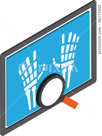 hand x ray illustration in 3D isometric style hand x ray illustration in 3D isometric style 96218882