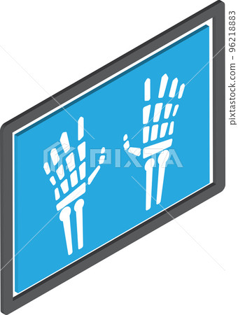 hand x ray illustration in 3D isometric style hand x ray illustration in 3D isometric style 96218883