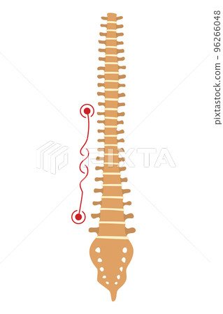 Spinal deformity. Symbol of spine curvatures or unhealthy backbones. Human spine anatomy, curved spine. Diagram with marked section. Body posture defect 96266048