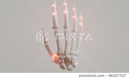 Polyarthrosis on white background - 3D rendering Polyarthrosis on white background - 3D rendering 96267707
