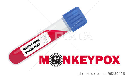 Blood sample tube for Monkeypox virus test concept vector. Test, lab tube with human blood. 96280428