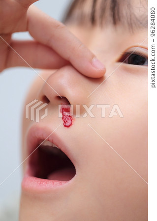 流鼻血的小學生（帶血的圖片） 96284080