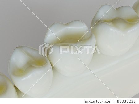 removed amalgam filling from a tooth- 3D Rendering 96339233