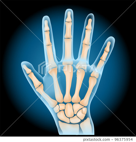 Carpal bones. x-ray blue realistic palm on dark background. 96375954