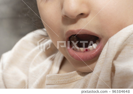 Little kid first milk tooth place - close up shot Little kid first milk tooth place - close up shot 96384648