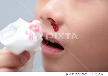 流鼻血的小學生(帶血的圖片) 流鼻血的小學生(帶血的圖片) 96392379