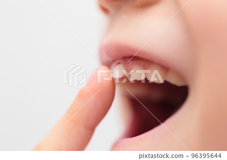 乳牙和恆牙都換過的小學生 96395644