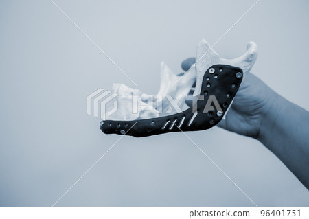 Person holding in hand 3D printed plastic prototype human lower jaw and medical titanium implant close-up. Prosthesis anatomical bone 3D printed from metal powder. Orthopedic maxillo-facial prosthesis 96401751