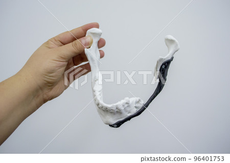 Person holding in hand 3D printed plastic prototype human lower jaw and medical titanium implant close-up. Prosthesis anatomical bone 3D printed from metal powder. Orthopedic maxillo-facial prosthesis 96401753