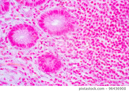 Backgrounds of Characteristics Tissue of Stomach Human, Small intestine Human, Pancreas Human and Large intestine Human under the microscope in Lab. Backgrounds of Characteristics Tissue of Stomach Human, Small intestine Human, Pancreas Human and Large intestine Human under the microscope in Lab. 96436908