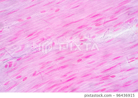 Backgrounds of Characteristics Tissue of Stomach Human, Small intestine Human, Pancreas Human and Large intestine Human under the microscope in Lab. 96436915