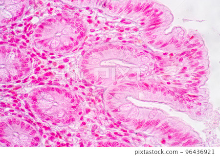 Backgrounds of Characteristics Tissue of Stomach Human, Small intestine Human, Pancreas Human and Large intestine Human under the microscope in Lab. Backgrounds of Characteristics Tissue of Stomach Human, Small intestine Human, Pancreas Human and Large intestine Human under the microscope in Lab. 96436921