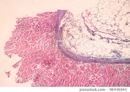 Backgrounds of Characteristics Tissue of Stomach Human, Small intestine Human, Pancreas Human and Large intestine Human under the microscope in Lab. Backgrounds of Characteristics Tissue of Stomach Human, Small intestine Human, Pancreas Human and Large intestine Human under the microscope in Lab. 96436943