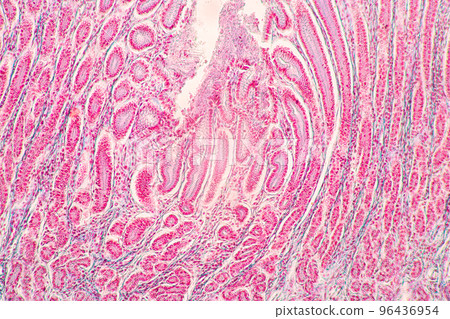 Backgrounds of Characteristics Tissue of Stomach Human, Small intestine Human, Pancreas Human and Large intestine Human under the microscope in Lab. 96436954
