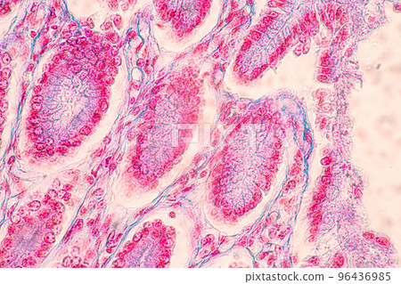 Backgrounds of Characteristics Tissue of Stomach Human, Small intestine Human, Pancreas Human and Large intestine Human under the microscope in Lab. 96436985