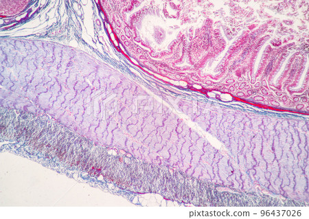 Backgrounds of Characteristics Tissue of Stomach Human, Small intestine Human, Pancreas Human and Large intestine Human under the microscope in Lab. 96437026