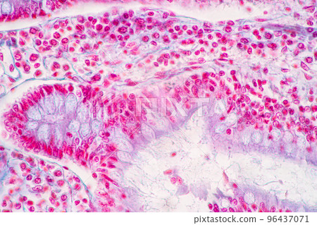 Backgrounds of Characteristics Tissue of Stomach Human, Small intestine Human, Pancreas Human and Large intestine Human under the microscope in Lab. Backgrounds of Characteristics Tissue of Stomach Human, Small intestine Human, Pancreas Human and Large intestine Human under the microscope in Lab. 96437071