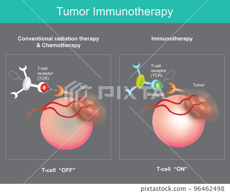 Tumor Immunotherapy. Cancer treatment that use the body's own immune system to prevent, control, and eliminate cancer cells. Tumor Immunotherapy. Cancer treatment that use the body's own immune system to prevent, control, and eliminate cancer cells. 96462498