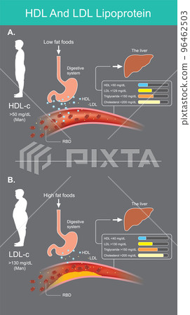 HDL And LDL Lipoprotein. Assessment of lipid levels in the blood from a laboratory blood test. Vector infographic. HDL And LDL Lipoprotein. Assessment of lipid levels in the blood from a laboratory blood test. Vector infographic. 96462503
