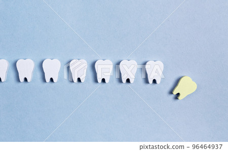 Teeth loss. Sick fallen tooth with cavity among healthy ones. Bad eating habits, poor oral hygiene, gum diseases. 96464937