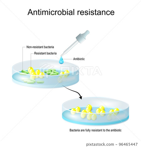 Antimicrobial resistance. Pipette with drop of antibiotic, and petri dish with colony of bacteria. Antimicrobial resistance. Pipette with drop of antibiotic, and petri dish with colony of bacteria. 96465447