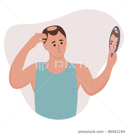 Man looking in the mirror at his baldness. Hair loss, alopecia in young age, hair problems. Vector illustration of a person with disease problems. 96481284
