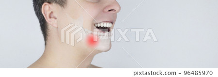 Schematic representation of pain in the jaw. Augmented reality. An x-ray of the jaw bone superimposed on a photograph. Painful areas are highlighted in red. Human bone disease. Osteomyelitis 96485970