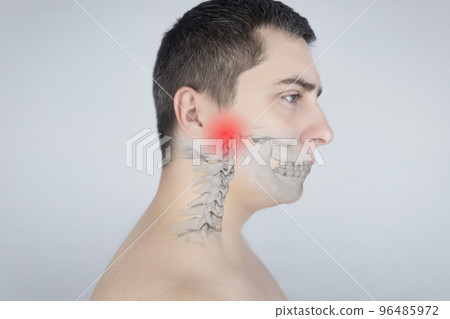 Schematic representation of pain in the jaw. Augmented reality. An x-ray of the jaw bone superimposed on a photograph. Painful areas are highlighted in red. Human bone disease. Osteomyelitis Schematic representation of pain in the jaw. Augmented reality. An x-ray of the jaw bone superimposed on a photograph. Painful areas are highlighted in red. Human bone disease. Osteomyelitis 96485972