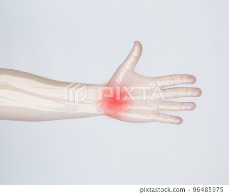 Rheumatoid arthritis. X-ray of the bones superimposed on the photo of a man. Diseases of the fingers and phalanges of the fingers. Treatment and diagnosis of inflammatory processes in bone tissues Rheumatoid arthritis. X-ray of the bones superimposed on the photo of a man. Diseases of the fingers and phalanges of the fingers. Treatment and diagnosis of inflammatory processes in bone tissues 96485975