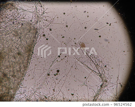 Pictures of creatures living in blue-green algae 96524562