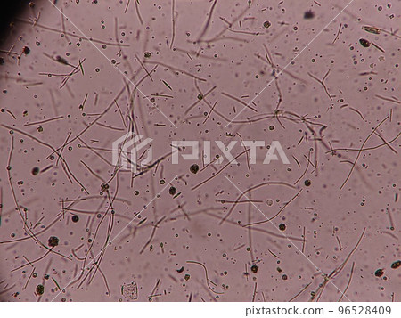 many freshwater creatures many freshwater creatures 96528409