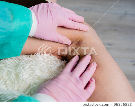 A traumatologist wearing medical gloves palpates the patient's injured leg. First aid concept for injuries. A traumatologist wearing medical gloves palpates the patient's injured leg. First aid concept for injuries. 96536858