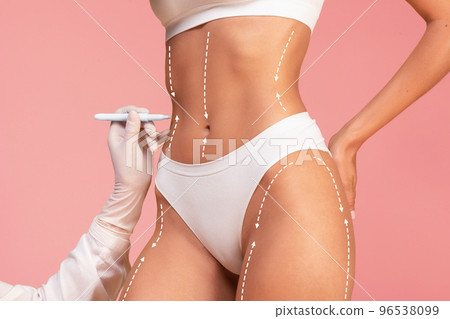 Doctor Drawing Dashed Line Marks On Female Body Before Plastic Surgery Operation 96538099