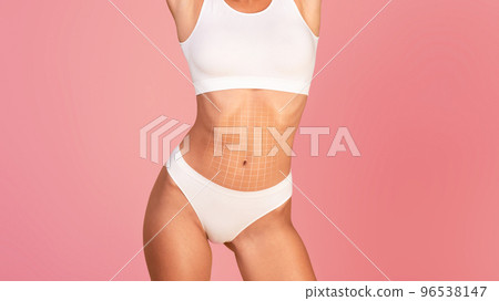 Abdominoplasty. Young Female In Underwear With Drawn Mesh On Flat Belly, Cropped Abdominoplasty. Young Female In Underwear With Drawn Mesh On Flat Belly, Cropped 96538147