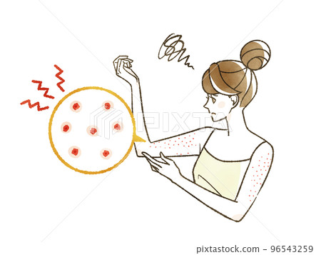 上臂皮膚粗糙的女人 96543259