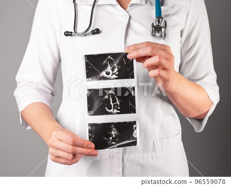 Heart ultrasound, cardiac scan, checkup result 96559078