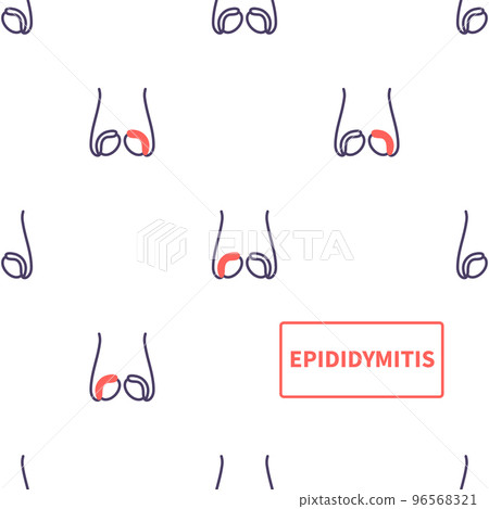 Epididymitis disease of testicles anatomy medical pattern 96568321