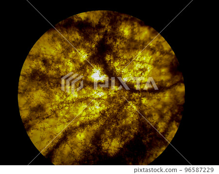 Rhizopus fungi specimen as seen through a microscope Rhizopus fungi specimen as seen through a microscope 96587229