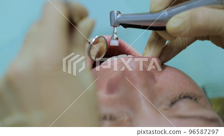 Woman cleaning teeth at the dentist. Dentist brushing teeth. Teeth whitening. Extreme shot of female teeth polishing with professional dental equipment. Dentist visit 96587297
